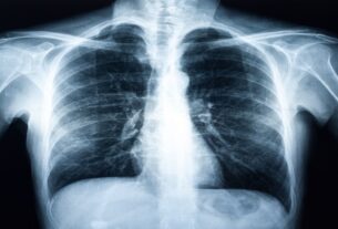 Locally Run Large Language Models May Help Preserve Patient Privacy