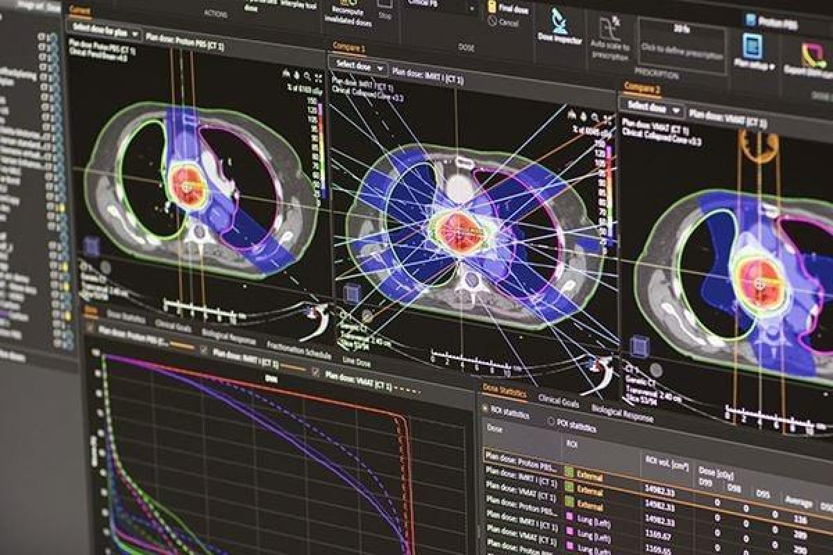 RaySearch and P-Cure Revolutionizing Proton Therapy Collaboration