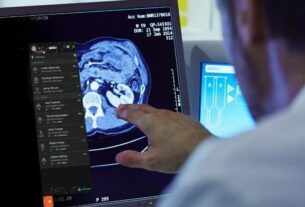 Aidoc Invests $30M to Develop Clinical AI Foundation Model