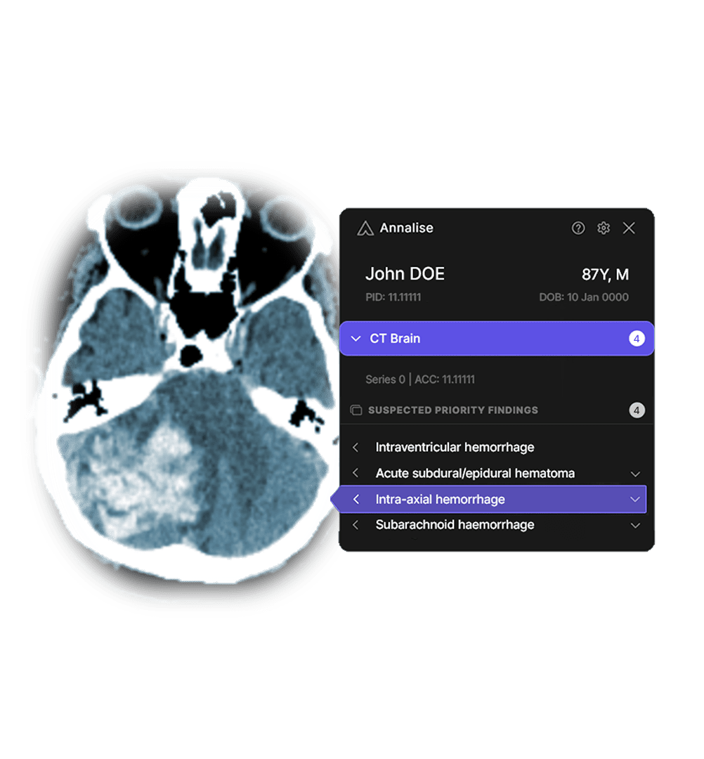 Avreo & Annalise.ai Integrate to Optimize Radiology Triage