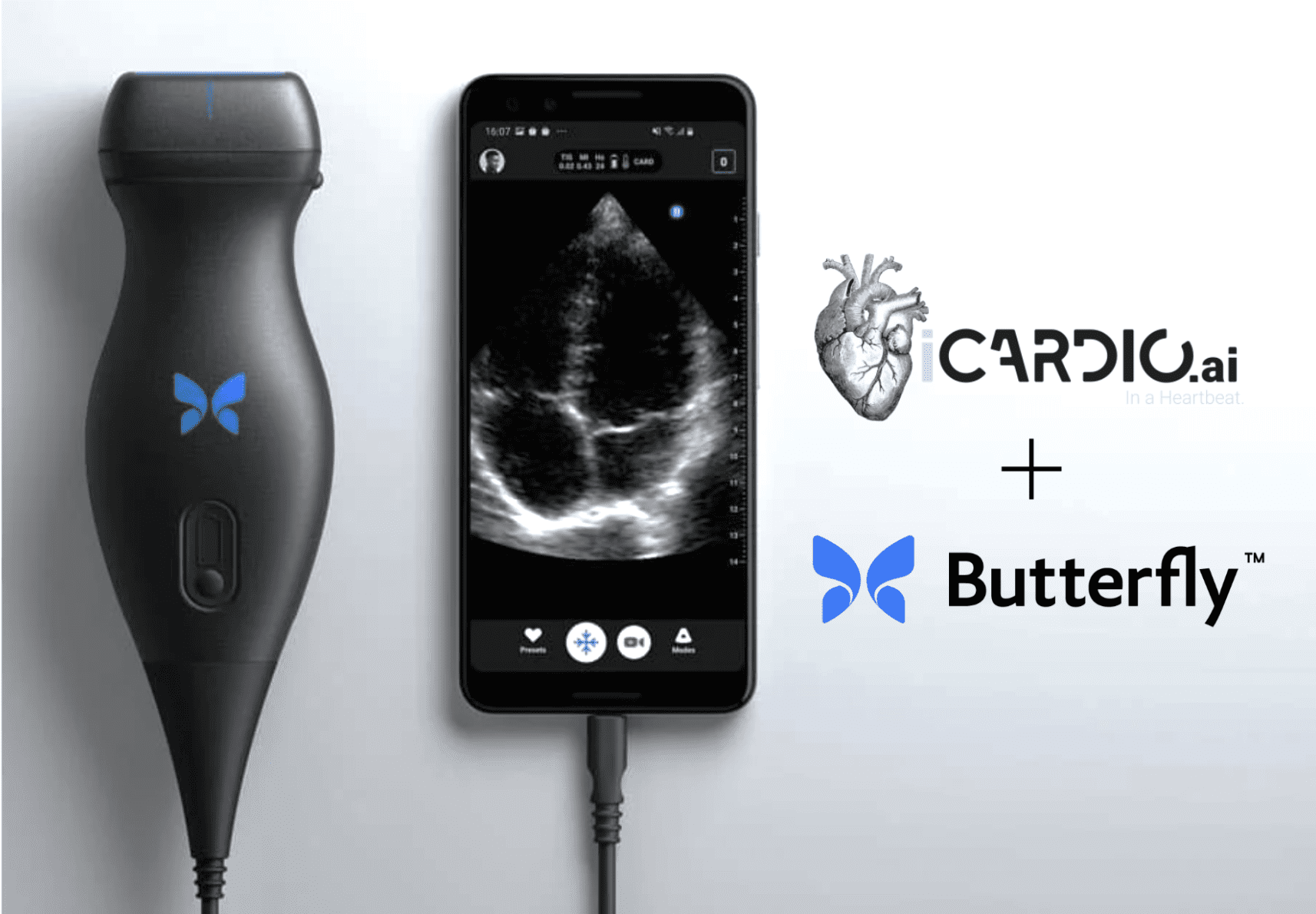 Butterfly Network, iCardio.ai Partner to Deploy Cardiac Ultrasound AI Tools