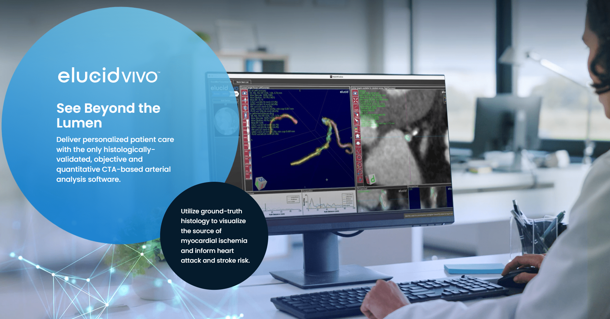 Elucid Raises $80M to Drive Commercialization of AI-powered Cardiovascular Diagnostic Tools