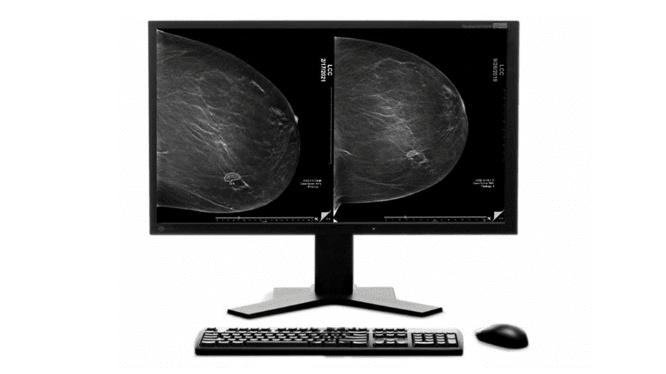 GE HealthCare Launches New AI Suite to Catch Breast Cancer Sooner - MedCity News
