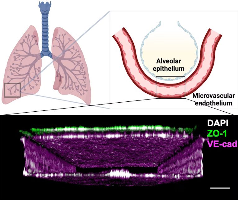 Lung Chip Mimics Radiation Injury |
