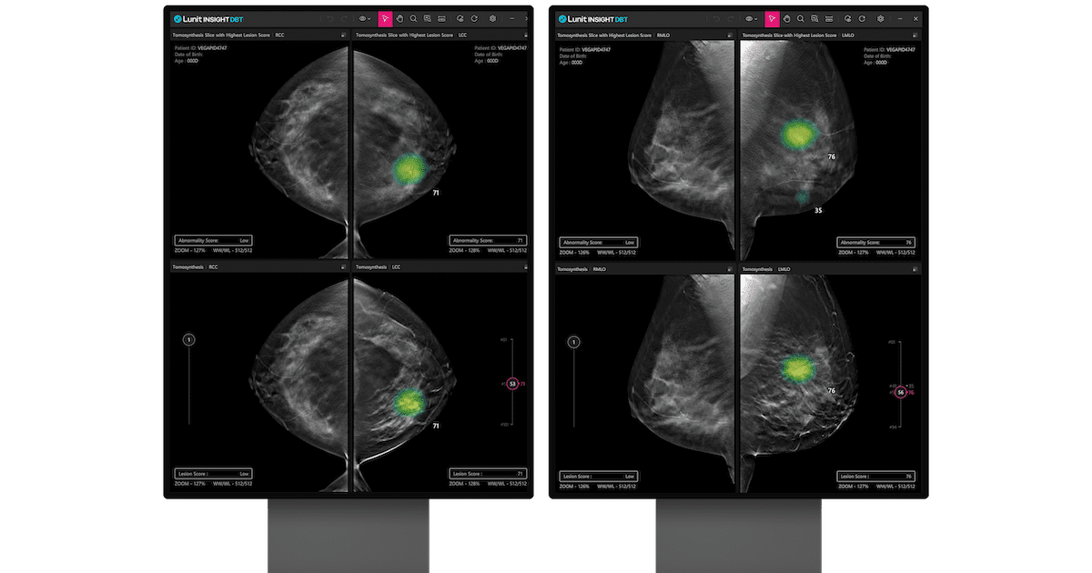 Lunit receives $150M capital chip-in, doubles down on US market