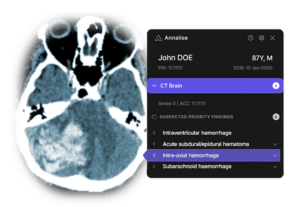 Mass General Brigham and Annalise.ai Collaborate to Develop AI-Enabled Diagnostic Products