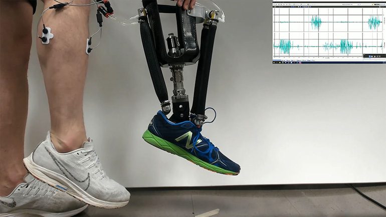 Robotic Ankle Helps with Postural Control in Amputees |
