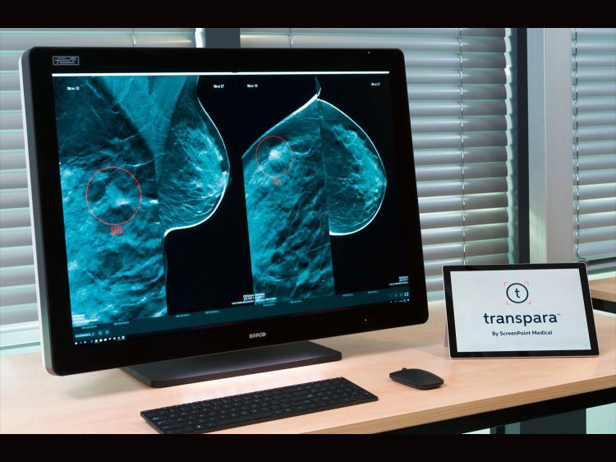 Transpara AI | Revolutionizing Early Cancer Detection in Radiology