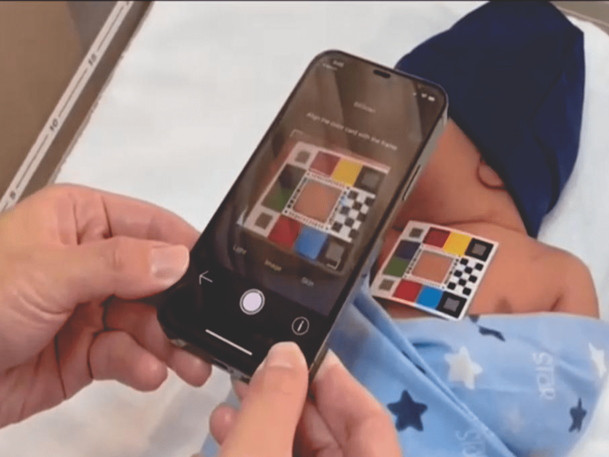 A Novel Smartphone App for Self-Monitoring of Neonatal Jaundice Among Postpartum Mothers: Qualitative Research Study