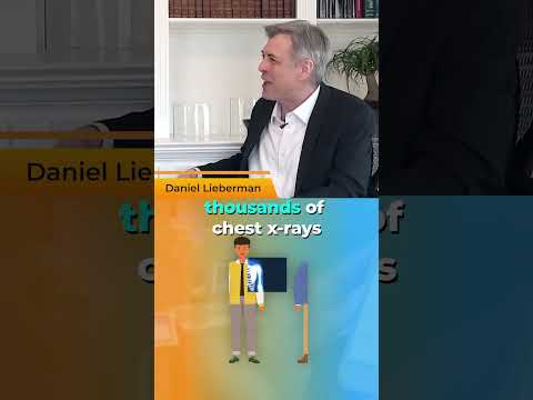 AI is already doing impossible things in healthcare