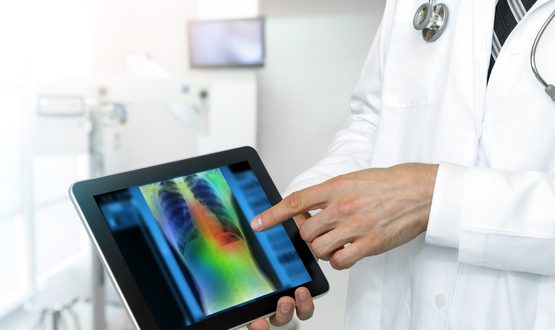 deepc and Qure.ai integration streamlines diagnostic workflows