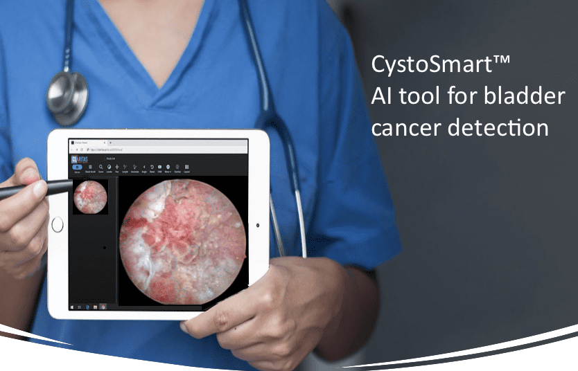 Intelligent Scopes and Mayo Clinic Partner to Develop AI-Powered Tools for Bladder Cancer