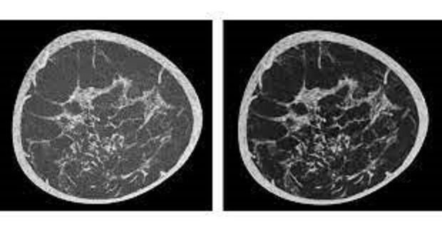 Koning Health Unveils Cutting-Edge Breast CT Technology at RSNA 2023