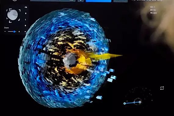 LUMA Vision | Revolutionizing 4D Cardiac Imaging Technology