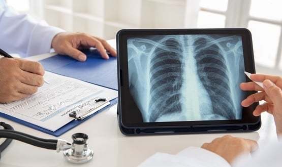NHS Greater Glasgow and Clyde to evaluate AI chest x-ray reporting