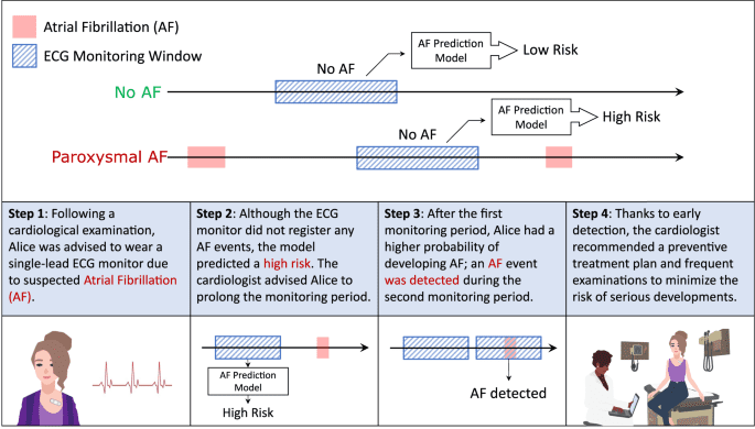 Prediction of atrial fibrillation from at-home single-lead ECG signals without arrhythmias