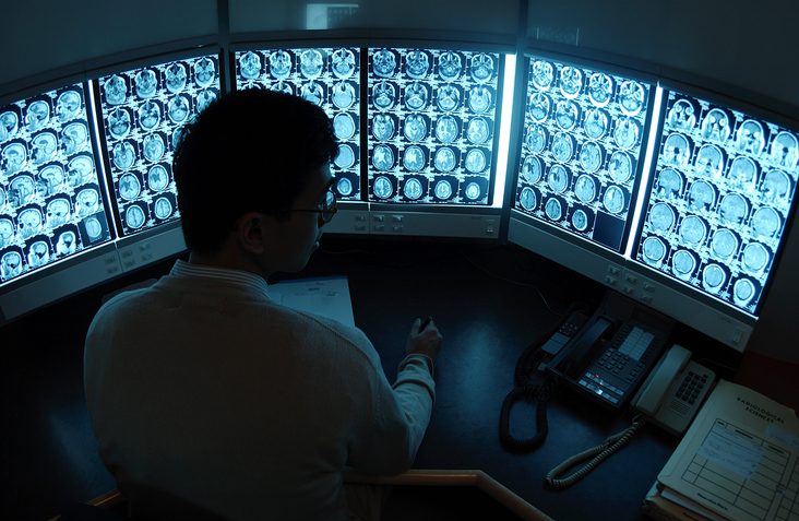 What Excites One Mayo Clinic Radiologist About AI in Her Field - MedCity News