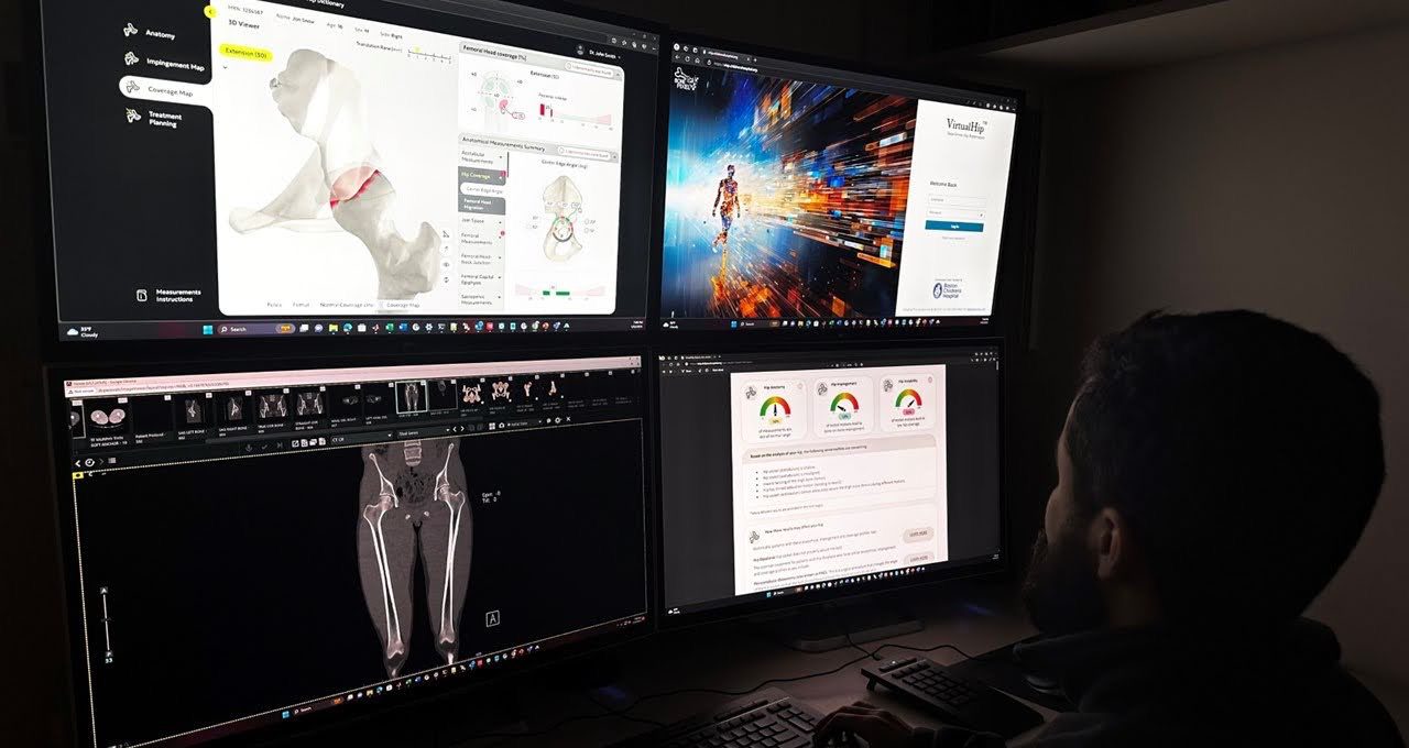 Boston Children’s Hospital Deploys Automated AI Tool for Hip Diagnosis