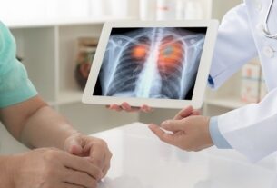 East Suffolk and North Essex NHS FT joins LungIMPACT study