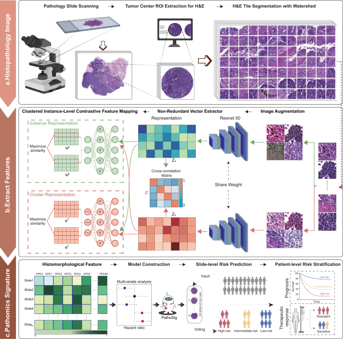 Histopathology images-based deep learning prediction of prognosis and therapeutic response in small cell lung cancer