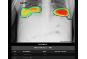 Lunit and Samsung Integrate to Power AI-Powered Chest Screenings