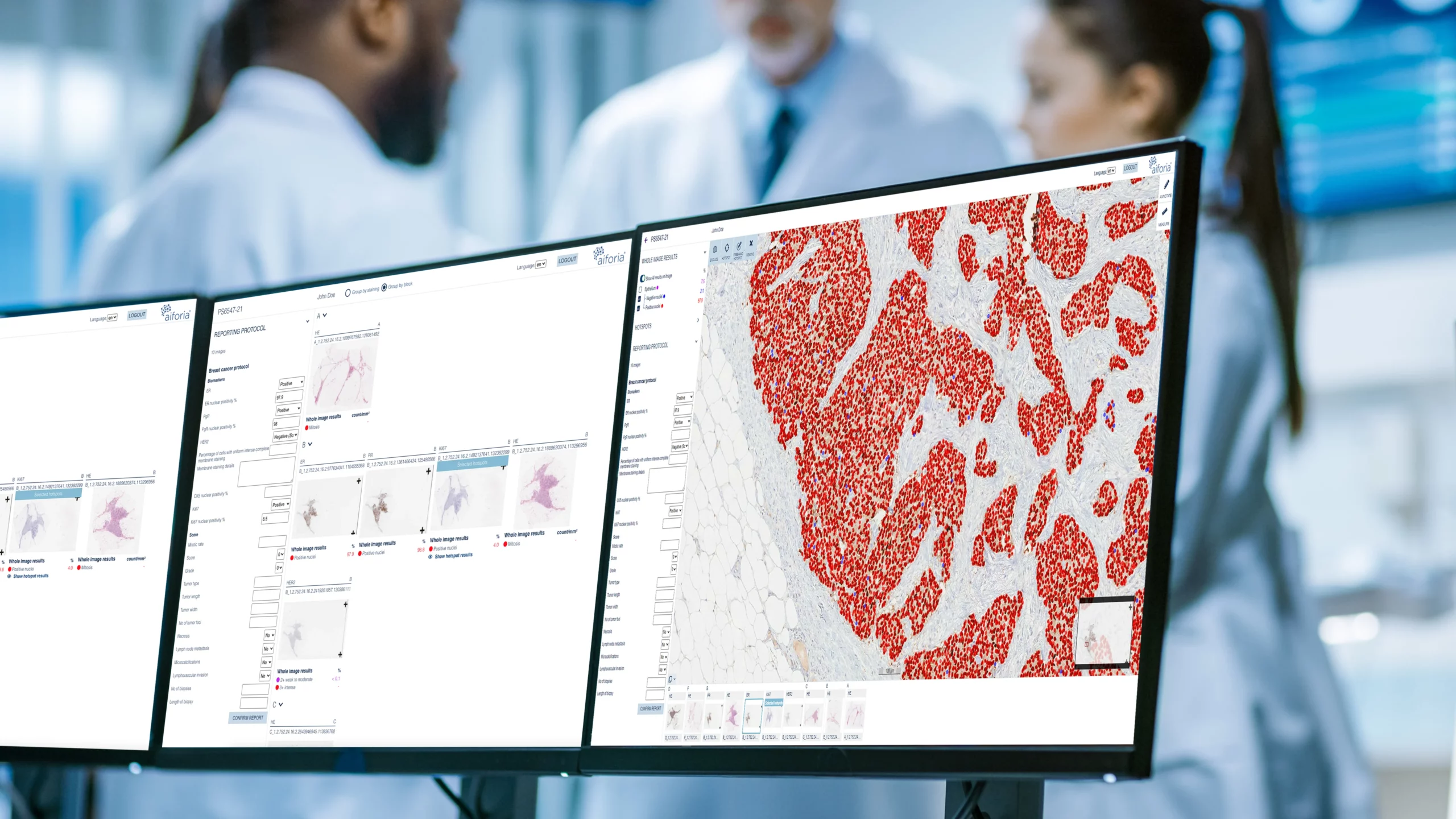 Mayo Clinic, Aiforia Partner on AI Model for Colorectal Cancer Recurrence