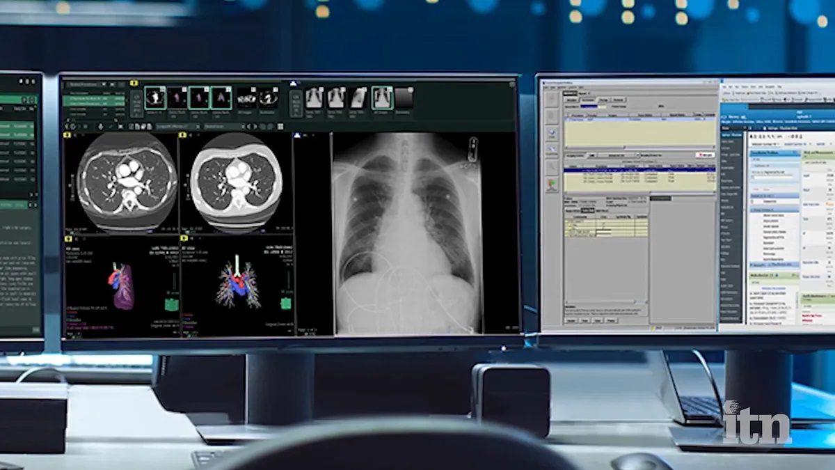 MyAgfaRadiologySolutions | Unveiling a Radiology Department Revolution