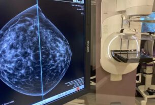RSNA 2023 Unveils AI Revolution in Breast Imaging