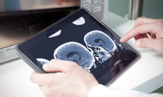 VRIS radiology information system formally launches in the UK 