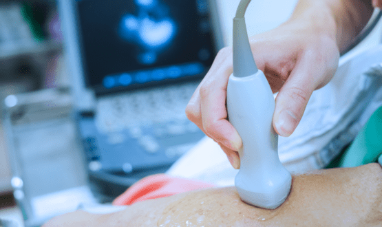 Lenus Health rolls out heart failure diagnostic at Blackpool CDC