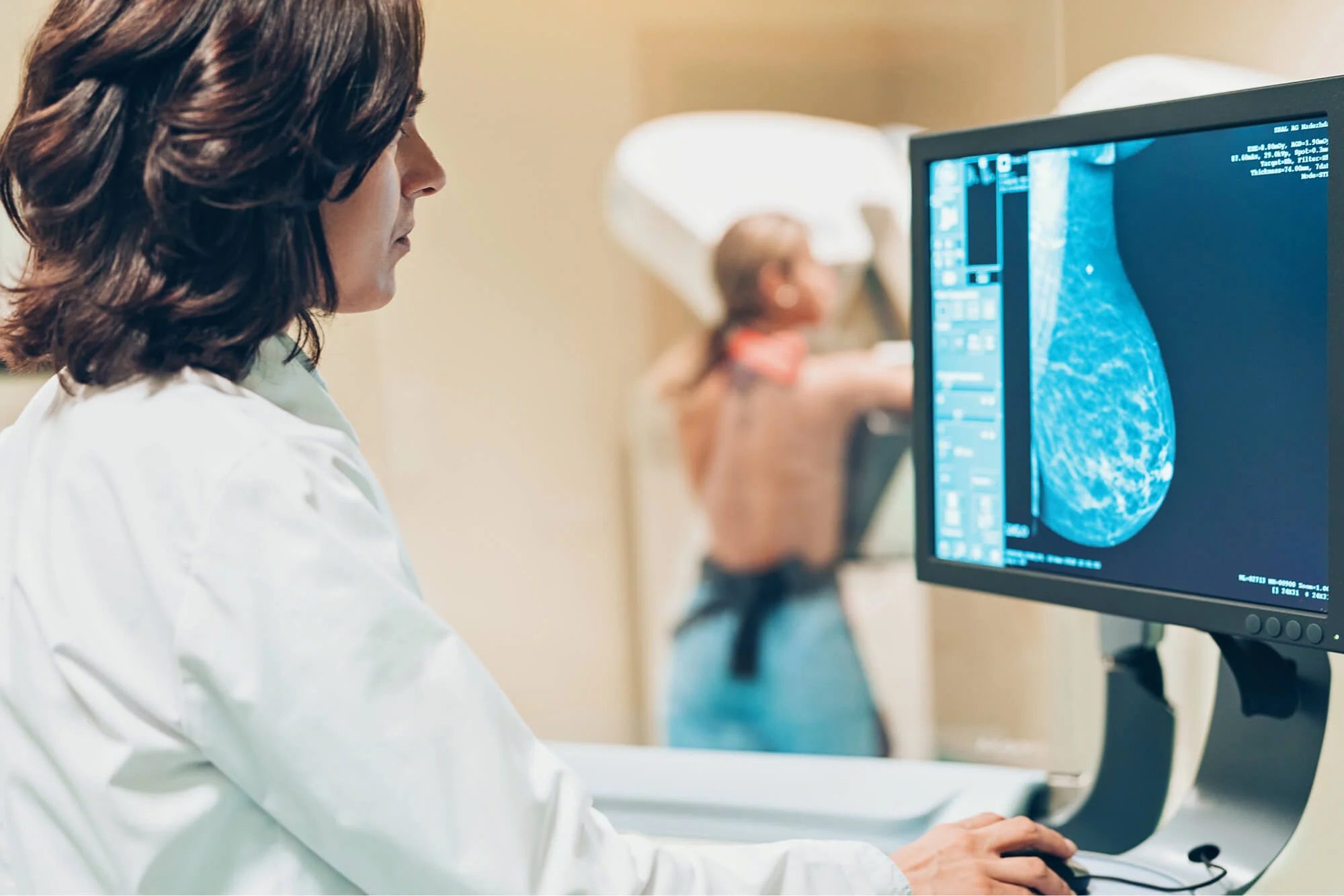 ScreenPoint Medical’s Transpara Breast AI Enhances Cancer Detection