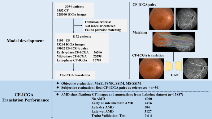 Translating color fundus photography to indocyanine green angiography using deep-learning for age-related macular degeneration screening