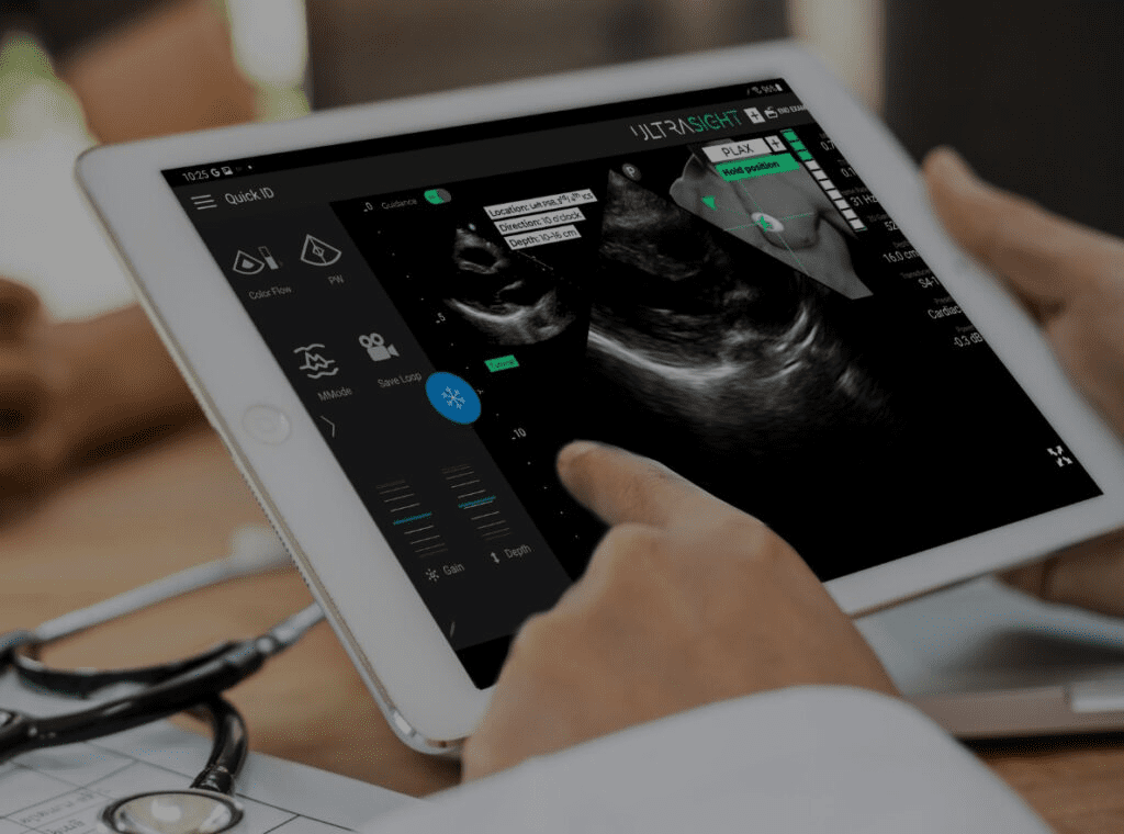 UltraSight, SELVAS Healthcare Partner to Bring AI-Powered Cardiac Ultrasound to Asia