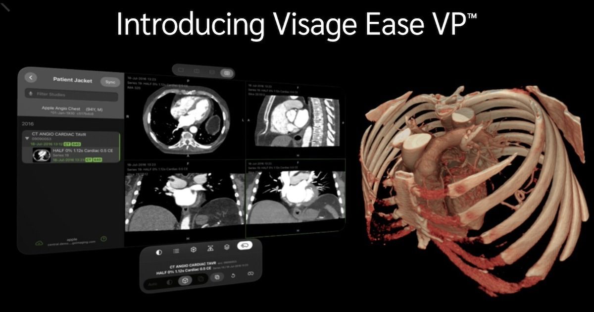 Visage Imaging Unveils Innovative Augmented Reality Diagnostic Solution