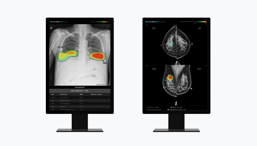 Lunit Expands AI-powered Cancer Screening Solution to France and Portugal