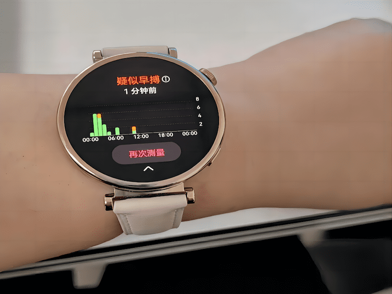 Mining User Reviews From Hypertension Management Mobile Health Apps to Explore Factors Influencing User Satisfaction and Their Asymmetry: Comparative Study