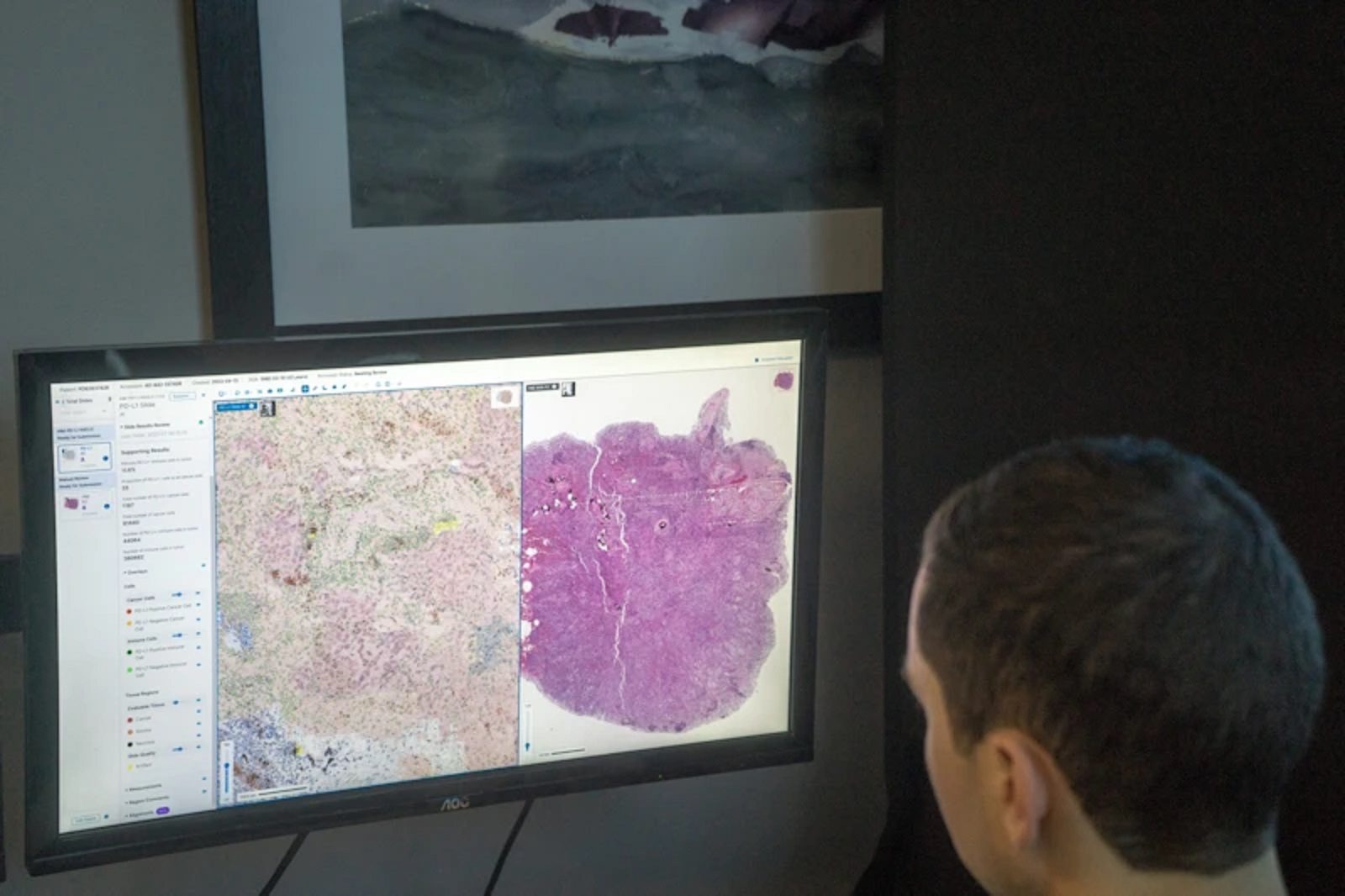 Pioneering Progress | Quantum Pathology Optimizes Digital Pathology with AISight