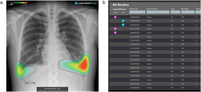 The lucent yet opaque challenge of regulating artificial intelligence in radiology