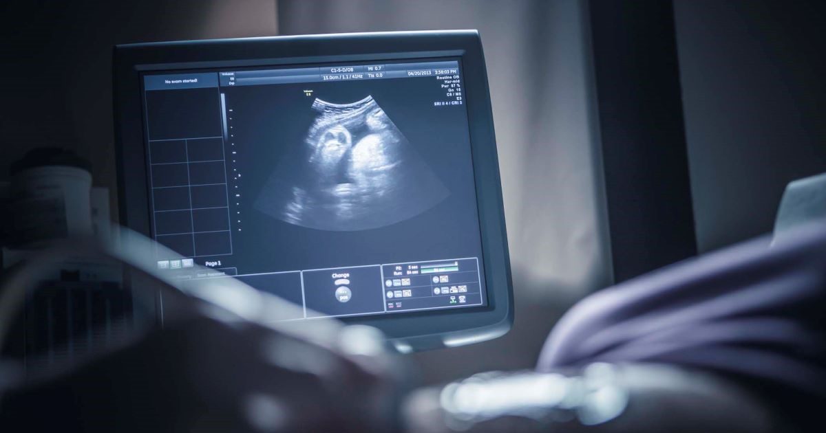 Clarius teams up with ThinkSono for AI-guided ultrasound system