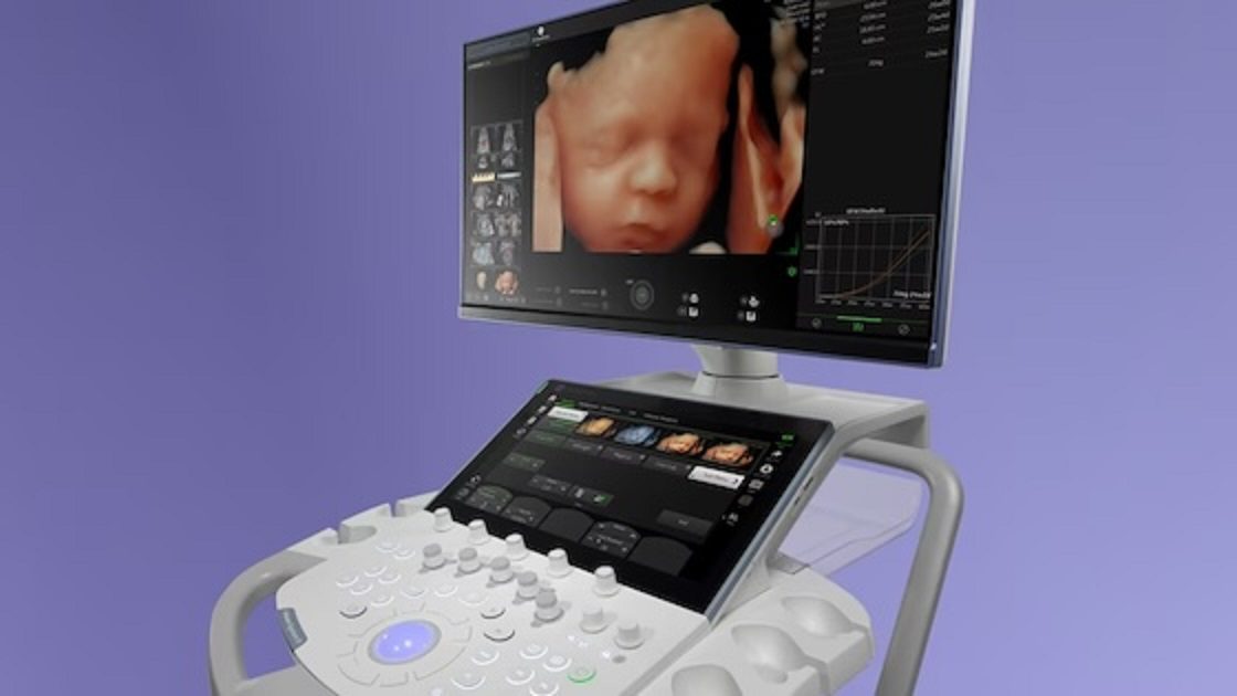 Revolutionizing Women’s Health | GE’s AI-Enhanced Ultrasound Systems