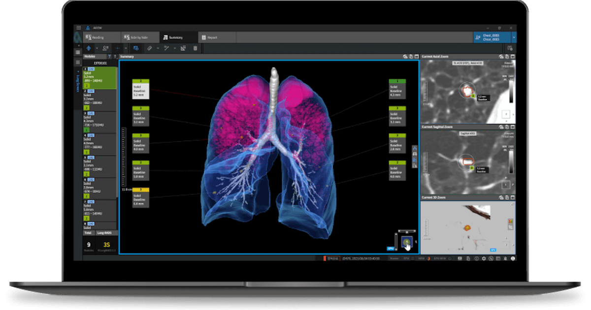 South Korean companies take on the European medical AI market and more partnership briefs