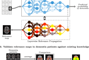 Constructing personalized characterizations of structural brain aberrations in patients with dementia using explainable artificial intelligence