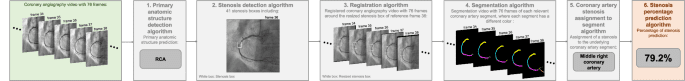 Evaluation of stenoses using AI video models applied to coronary angiography