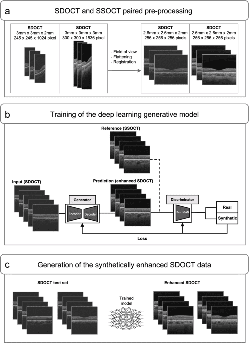Optical coherence tomography choroidal enhancement using generative deep learning