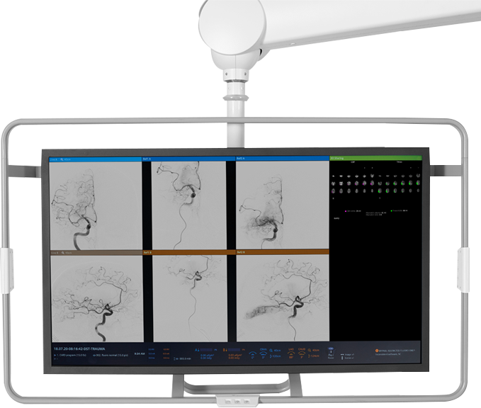 RapidAI Scores FDA Clearance, Bringing AI-Powered Stroke Assessment to the Interventional Suite
