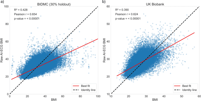 Artificial intelligence-enhanced electrocardiography derived body mass index as a predictor of future cardiometabolic disease