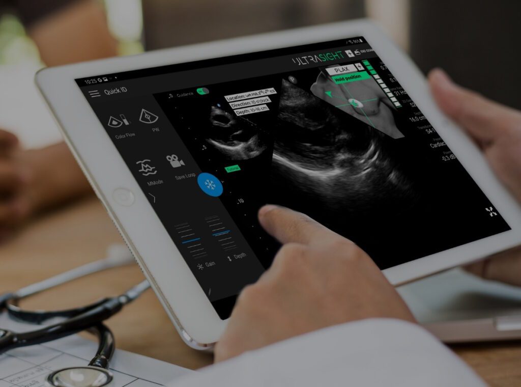 Mayo Clinic Taps UltraSight to Advance AI-Powered Ultrasound for Cardiac Care