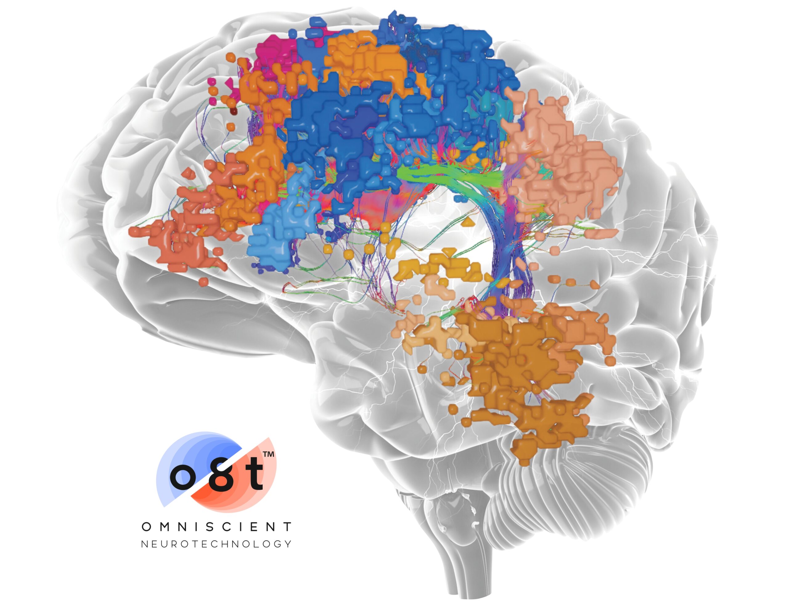 Omniscient Secures Funding to Expand AI-Powered Brain Mapping