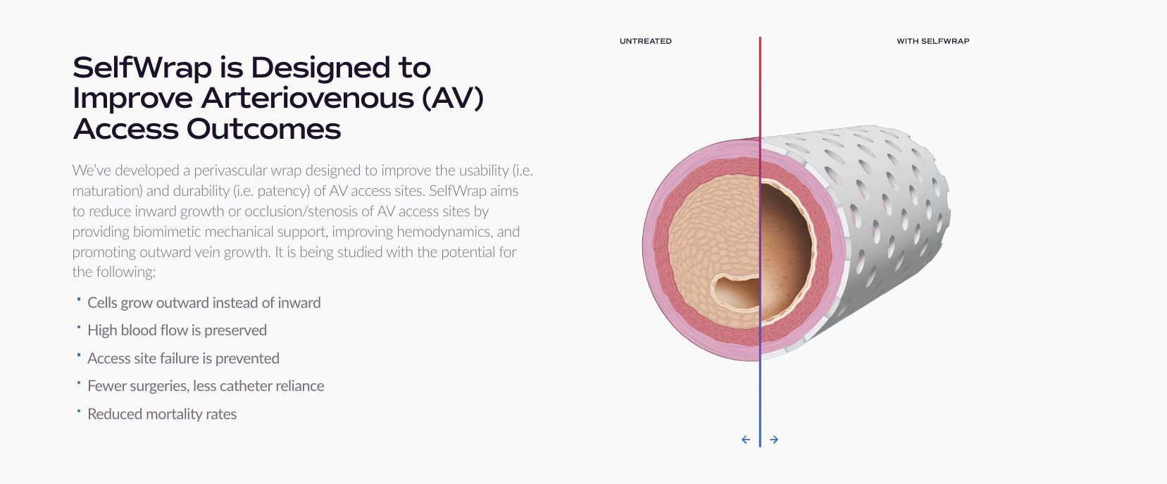 VenoStent Raises $20M for Dialysis Solution, Secures $3.6M NIH Grant for U.S. Dialysis Therapeutic Clinical Trial