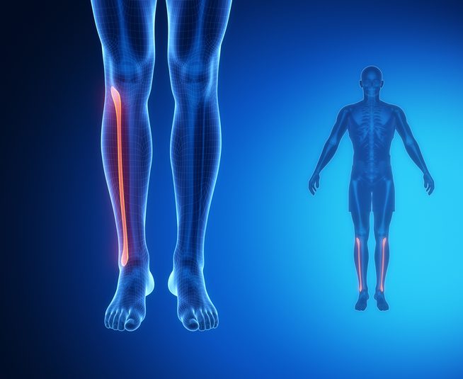 Breaking the Cycle of Chronic Pain: How Digital Care Can Address a Global Issue - MedCity News